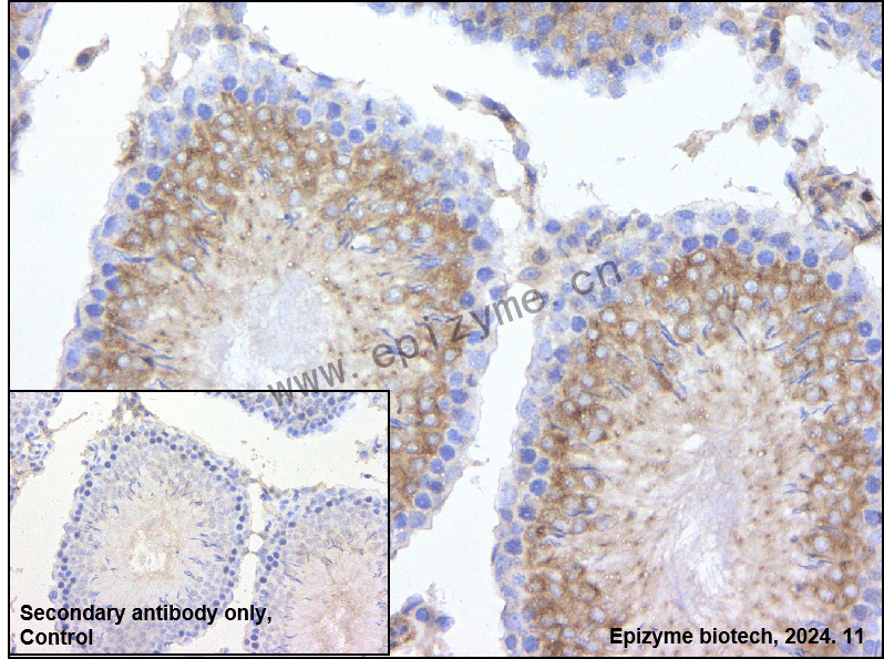Anti-CDK5RAP3 Rabbit mAb [69M02M13]
