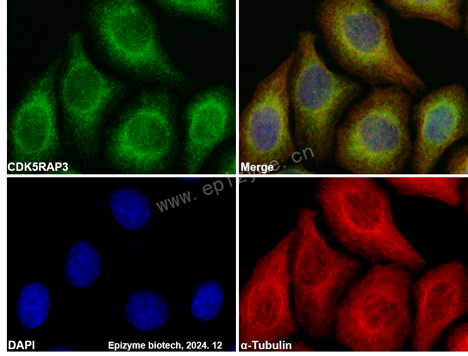 Anti-CDK5RAP3 Rabbit mAb [69M02M13]