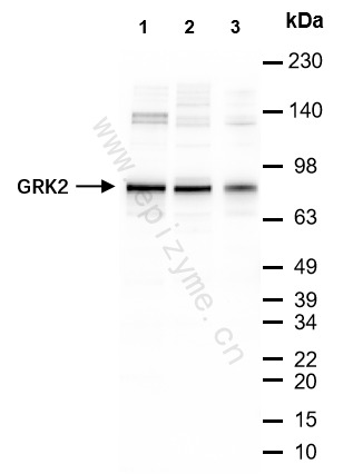 Anti-GRK2 Rabbit mAb [53L08M80]