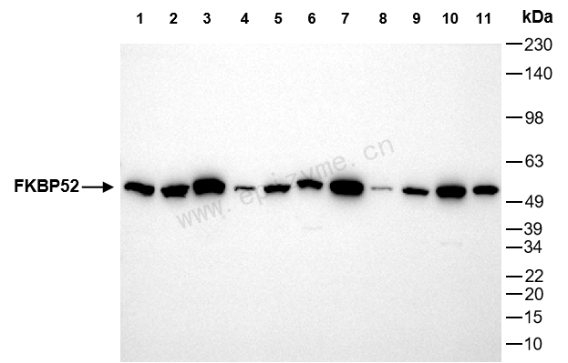 Anti-FKBP52 Rabbit mAb [22L94K82]