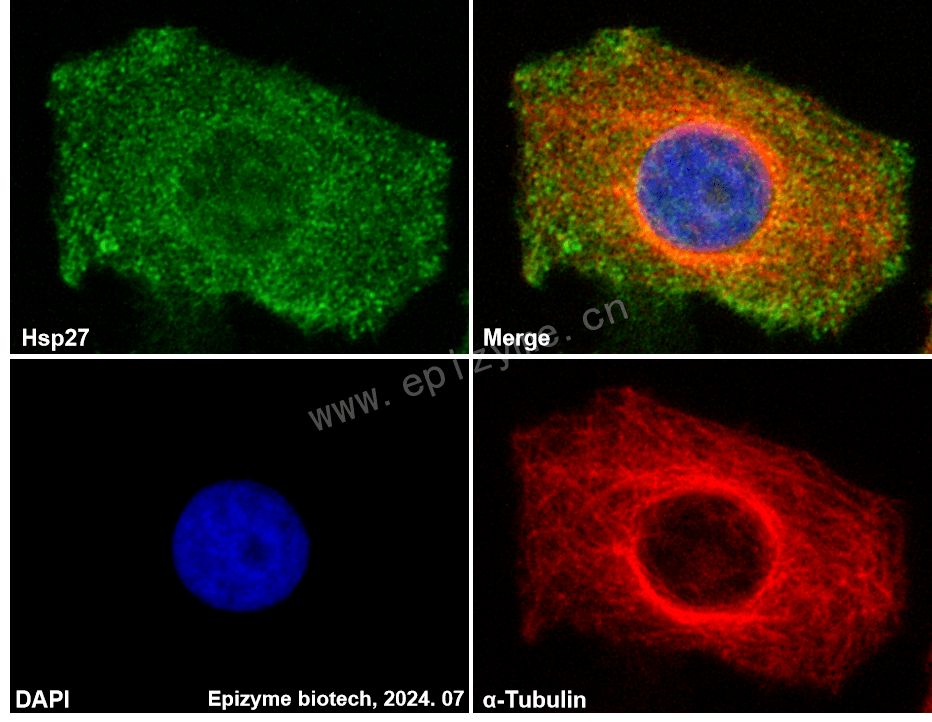 Anti-Hsp27 Rabbit mAb [54K11L13]