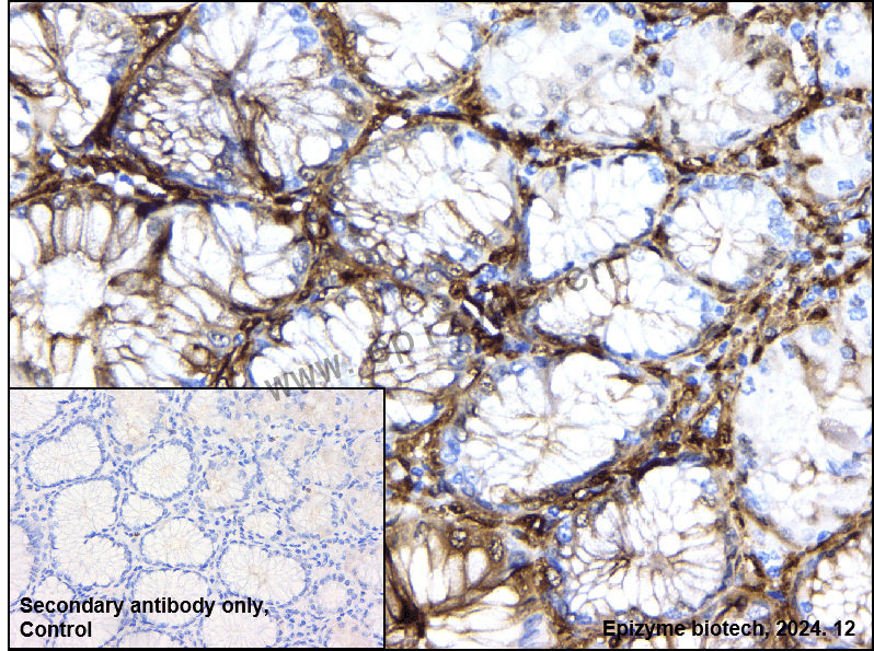 Anti-Hsp27 Rabbit mAb [54K11L13]