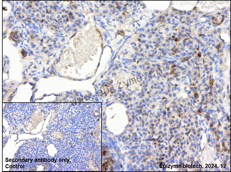 Anti-Hsp27 Rabbit mAb [54K11L13]