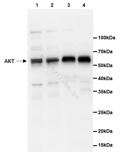 Anti-AKT1/2/3 Rabbit mAb [69K96M86]