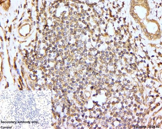 Anti-AKT1/2/3 Rabbit mAb [69K96M86]