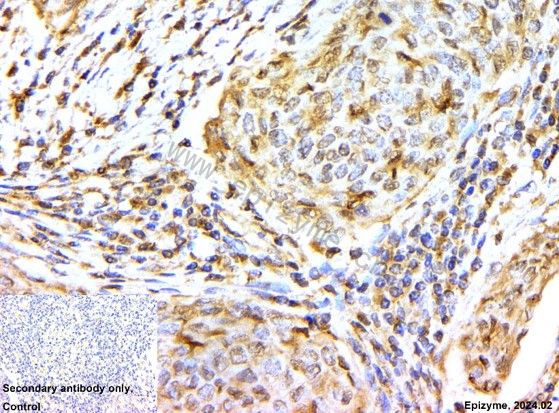Anti-AKT1/2/3 Rabbit mAb [69K96M86]