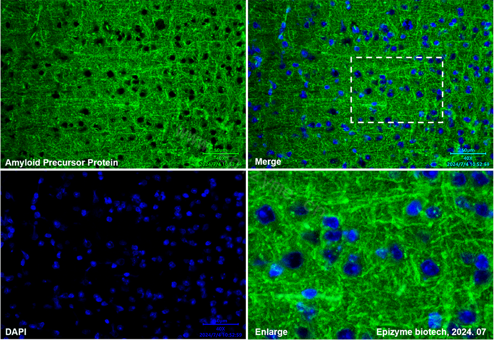 Anti-Amyloid Precursor Protein Rabbit mAb [26K25L88]