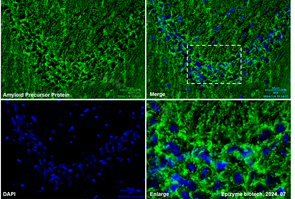 Anti-Amyloid Precursor Protein Rabbit mAb [26K25L88]