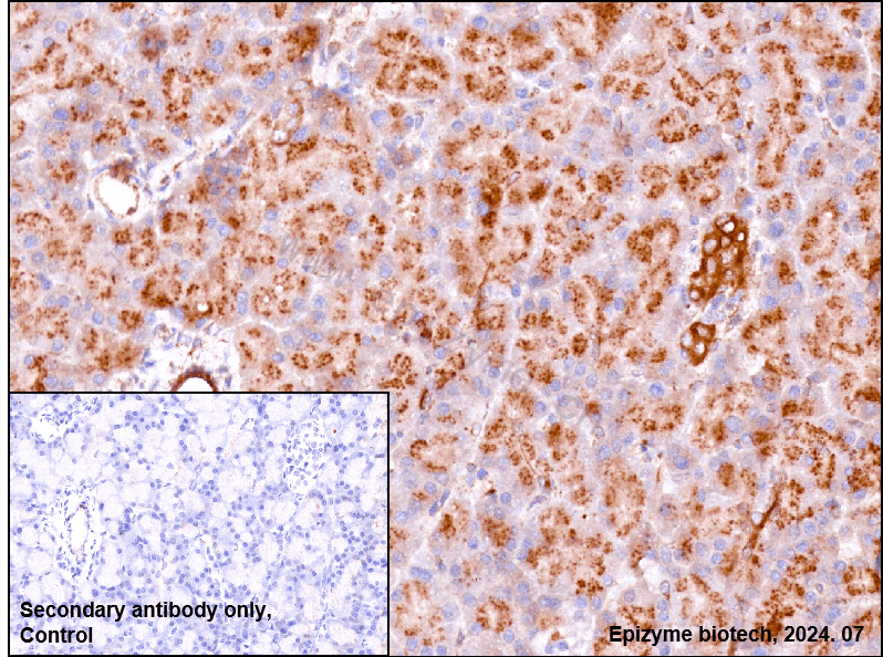 Anti-Amyloid Precursor Protein Rabbit mAb [26K25L88]