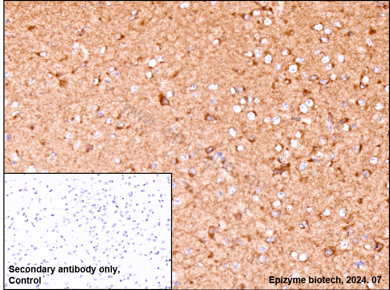 Anti-Amyloid Precursor Protein Rabbit mAb [26K25L88]