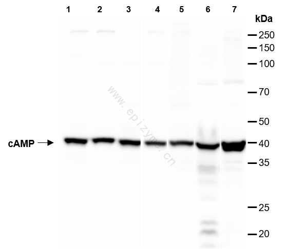 Anti-cAMP Protein Kinase Catalytic Subunit Rabbit mAb [66L59L61]