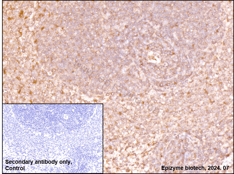 Anti-cAMP Protein Kinase Catalytic Subunit Rabbit mAb [66L59L61]