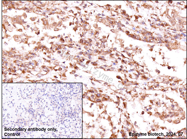 Anti-cAMP Protein Kinase Catalytic Subunit Rabbit mAb [66L59L61]