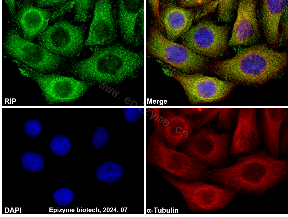 Anti-RIP Rabbit mAb [24K02L44]