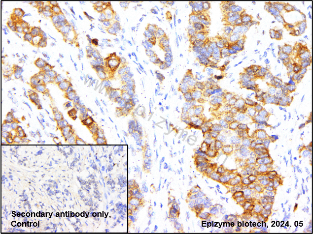 Anti-Phospho-Tau (Thr205) Rabbit mAb [88L72L20]