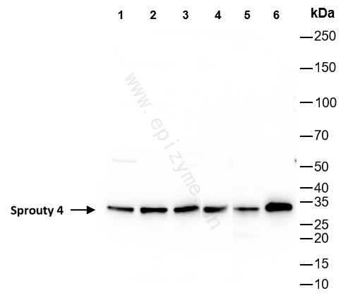Anti-Sprouty 4 Rabbit mAb [73M97L48]