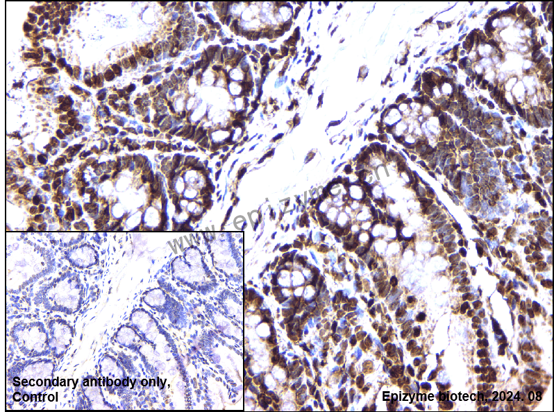 Anti-Sprouty 4 Rabbit mAb [73M97L48]