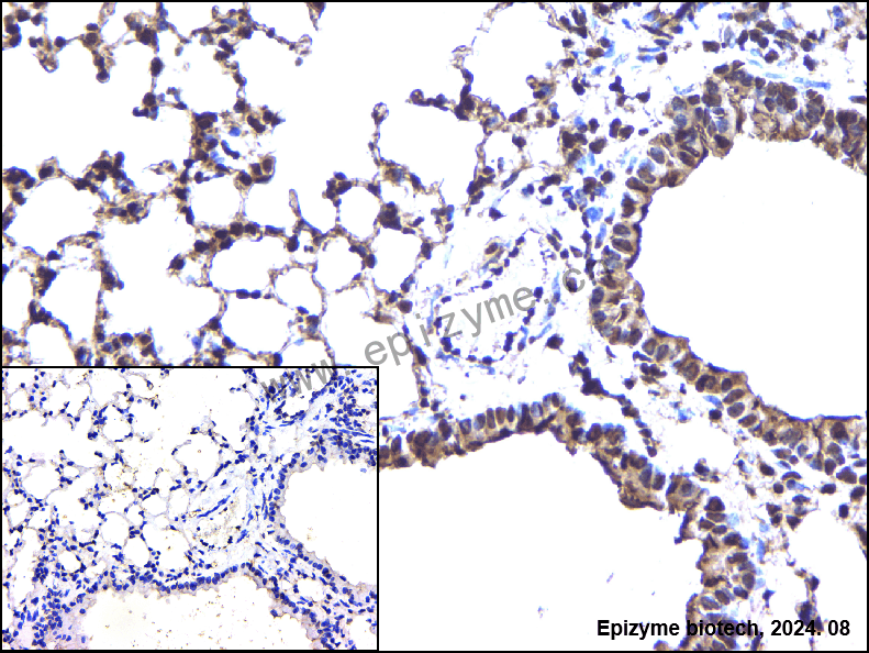 Anti-Sprouty 4 Rabbit mAb [73M97L48]
