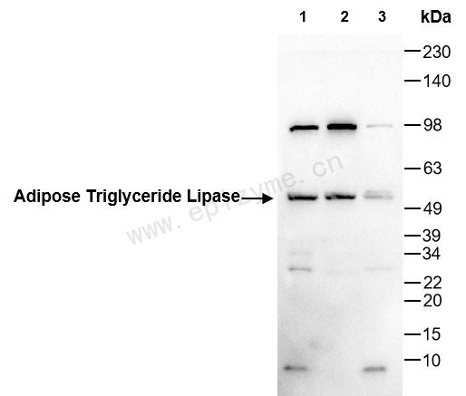 Anti-Adipose Triglyceride Lipase Rabbit mAb [11L57K82]