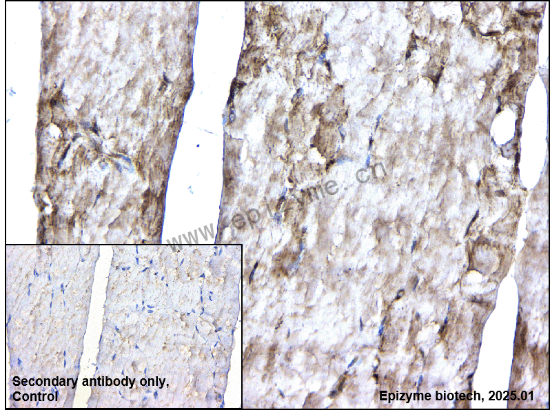 Anti-Adipose Triglyceride Lipase Rabbit mAb [11L57K82]