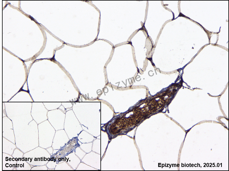 Anti-Adipose Triglyceride Lipase Rabbit mAb [11L57K82]