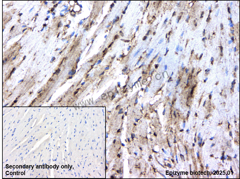 Anti-Adipose Triglyceride Lipase Rabbit mAb [11L57K82]