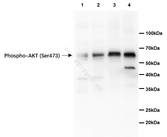 Anti-Phospho-AKT (Ser473) Rabbit mAb [81M88K84]