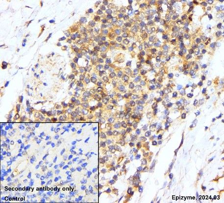 Anti-Phospho-AKT (Ser473) Rabbit mAb [81M88K84]