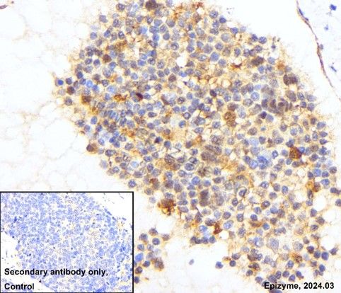 Anti-Phospho-AKT (Ser473) Rabbit mAb [81M88K84]