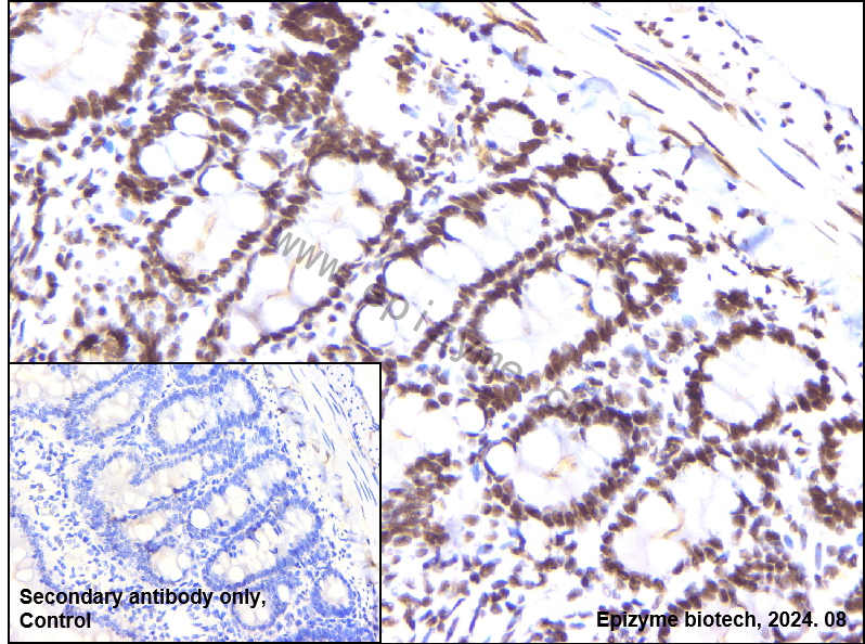 Anti-Rad21 Rabbit mAb [31K39K34]