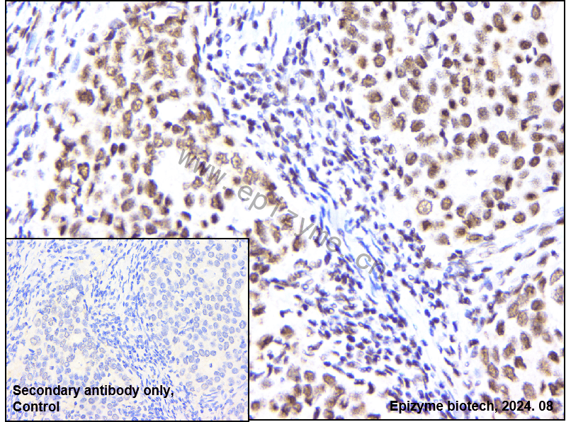 Anti-Rad21 Rabbit mAb [31K39K34]