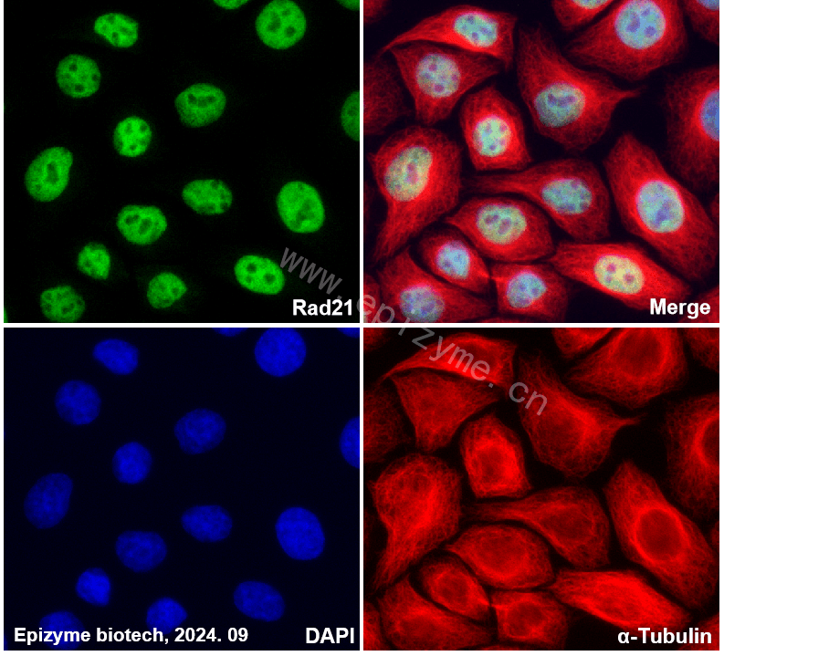 Anti-Rad21 Rabbit mAb [31K39K34]