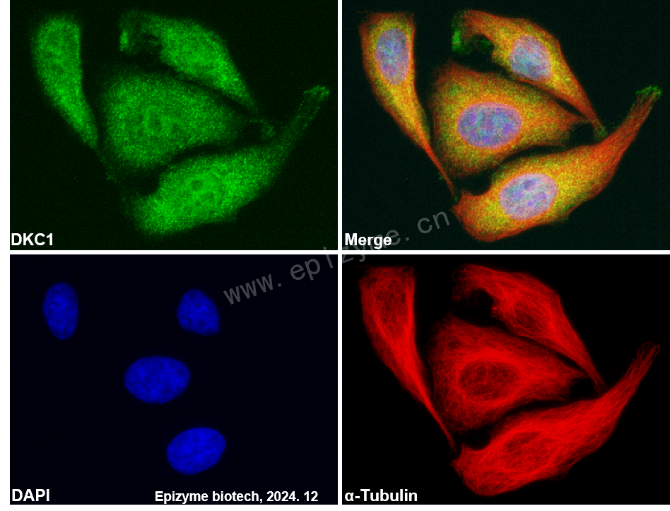 Anti-DKC1 Rabbit mAb [38M95K93]