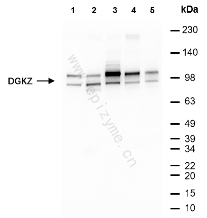 Anti-DGKZ Rabbit mAb [97K74L70]