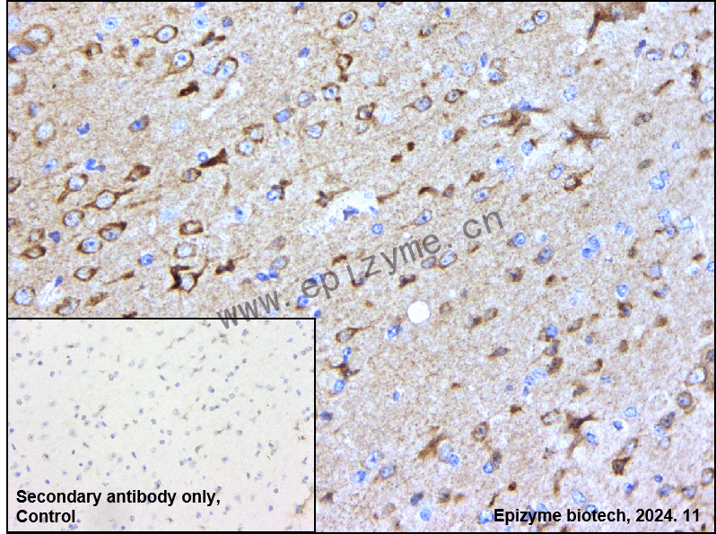 Anti-DGKZ Rabbit mAb [97K74L70]