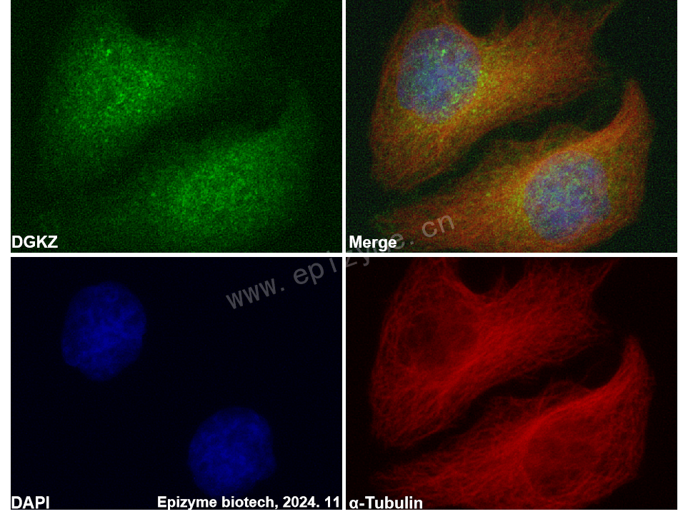 Anti-DGKZ Rabbit mAb [97K74L70]