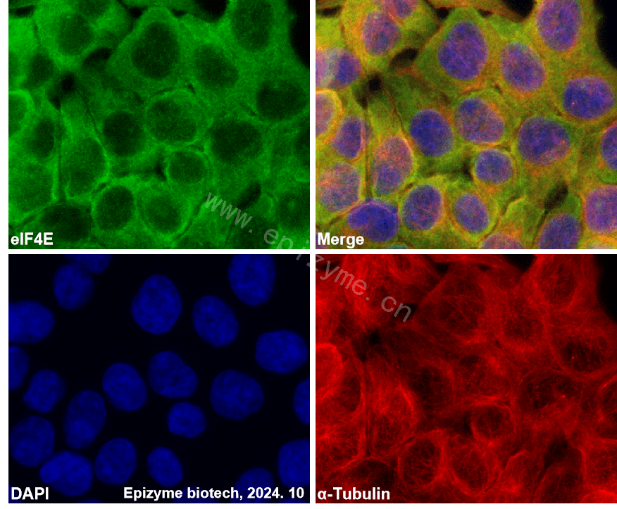 Anti-eIF4E Rabbit mAb [39L32M79]