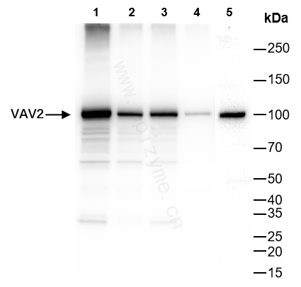 Anti-VAV2 Rabbit mAb [43K64L80]