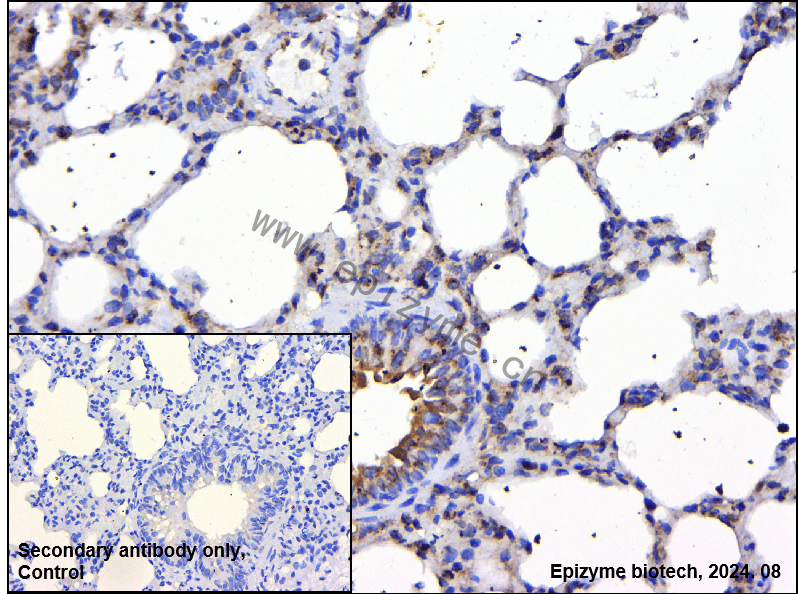 Anti-VAV2 Rabbit mAb [43K64L80]