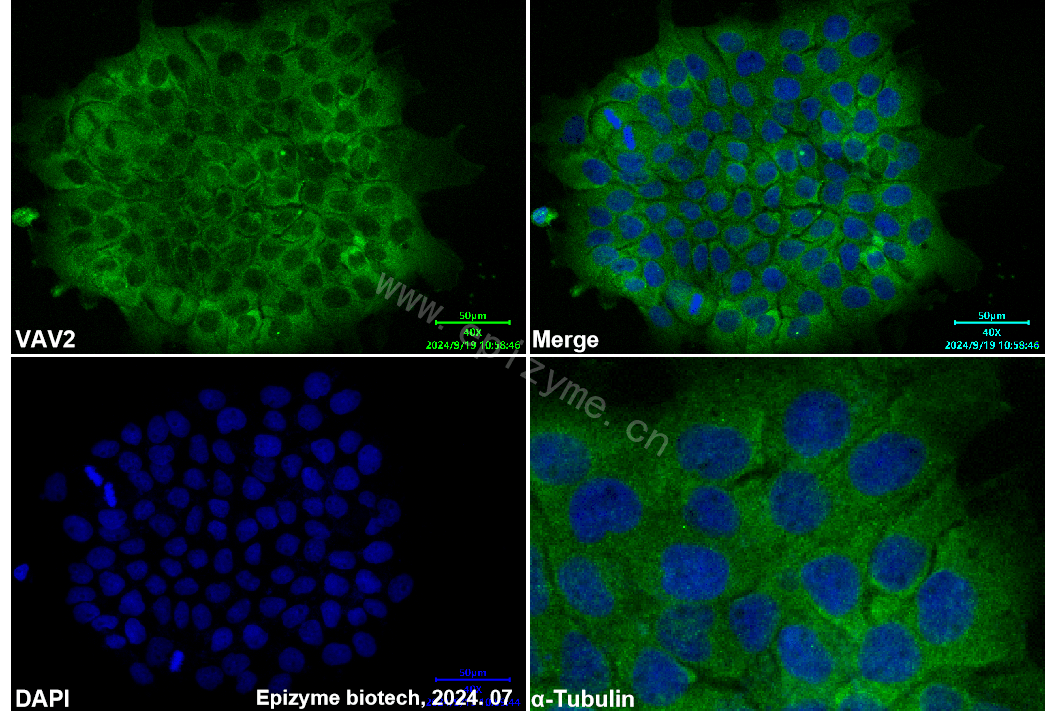 Anti-VAV2 Rabbit mAb [43K64L80]