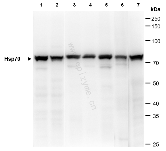 Anti-Hsp70 Rabbit mAb [38L56K50]