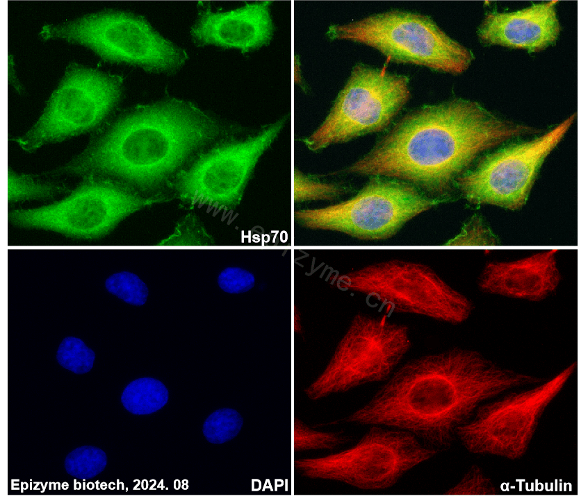 Anti-Hsp70 Rabbit mAb [38L56K50]