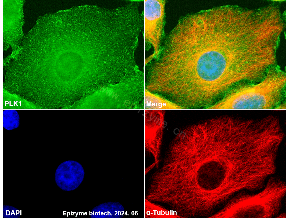 Anti-PLK1 Rabbit mAb [91M71M26]