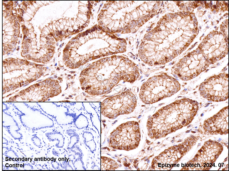Anti-PLK1 Rabbit mAb [91M71M26]