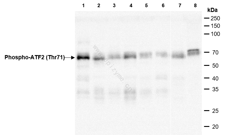 Anti-Phospho-ATF2 (Thr71) Rabbit mAb [72K17M64]