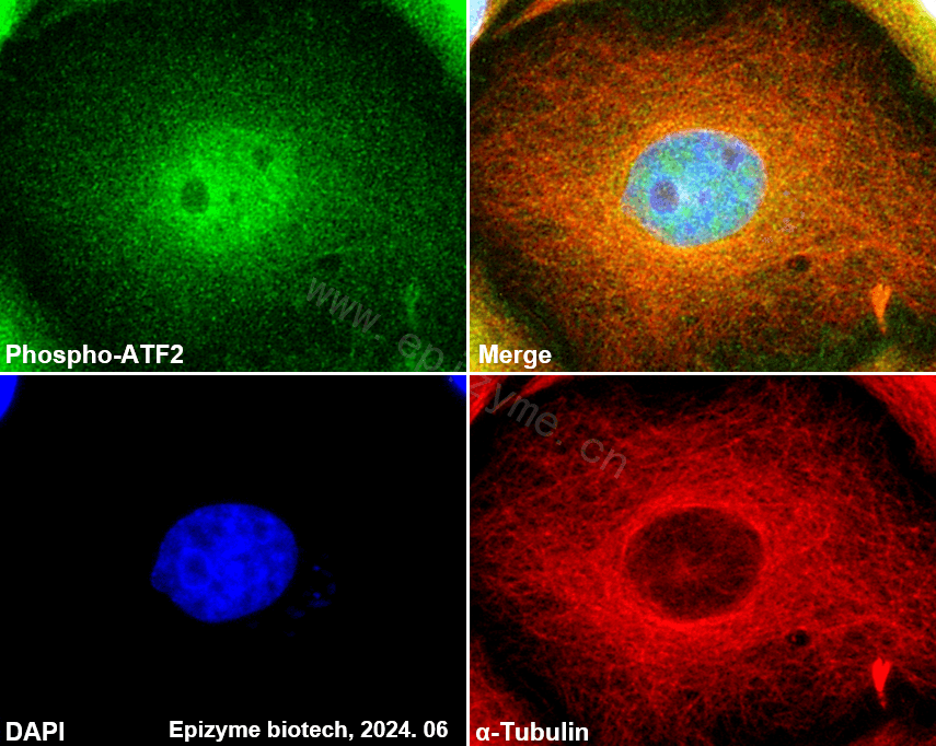 Anti-Phospho-ATF2 (Thr71) Rabbit mAb [72K17M64]