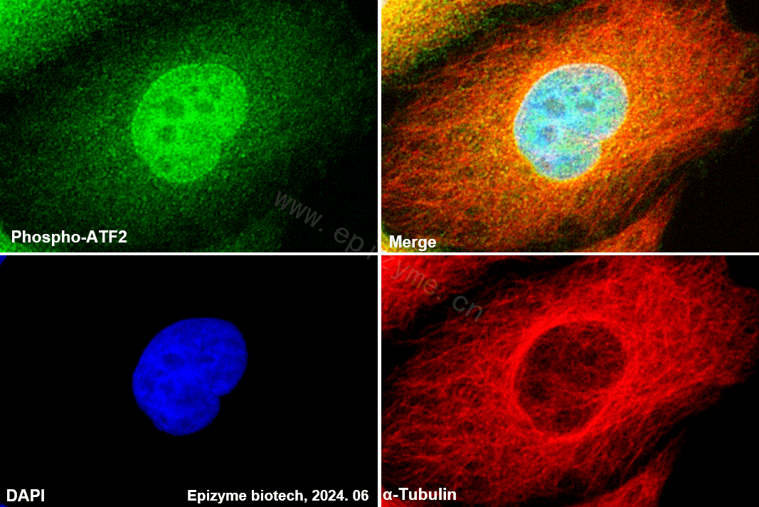 Anti-Phospho-ATF2 (Thr71) Rabbit mAb [72K17M64]