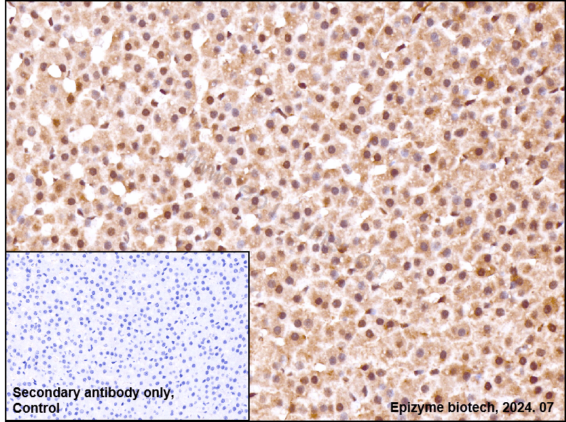 Anti-Phospho-ATF2 (Thr71) Rabbit mAb [72K17M64]