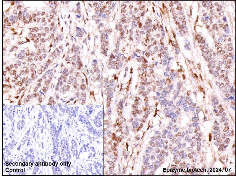 Anti-Phospho-ATF2 (Thr71) Rabbit mAb [72K17M64]
