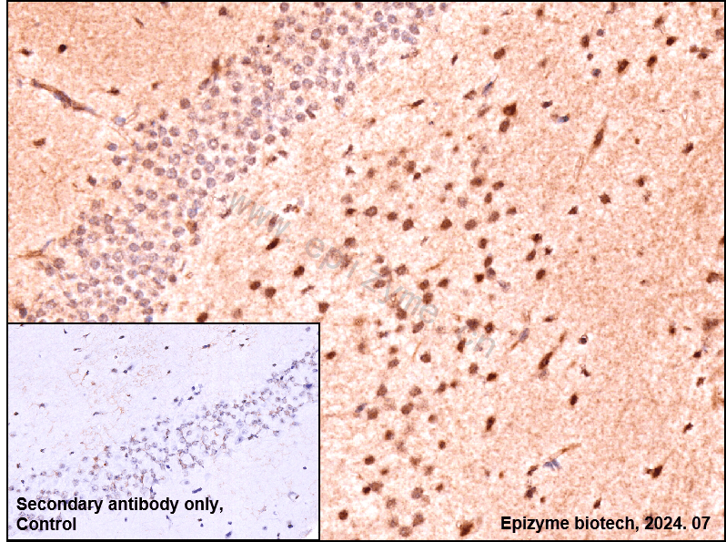 Anti-Phospho-ATF2 (Thr71) Rabbit mAb [72K17M64]
